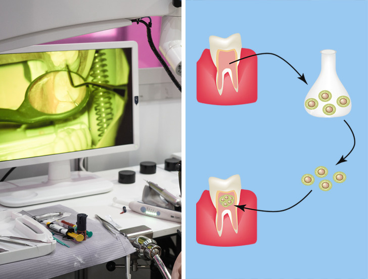 Discoveries that will leave you with your mouth wide open - Regenerate fallen out teeth